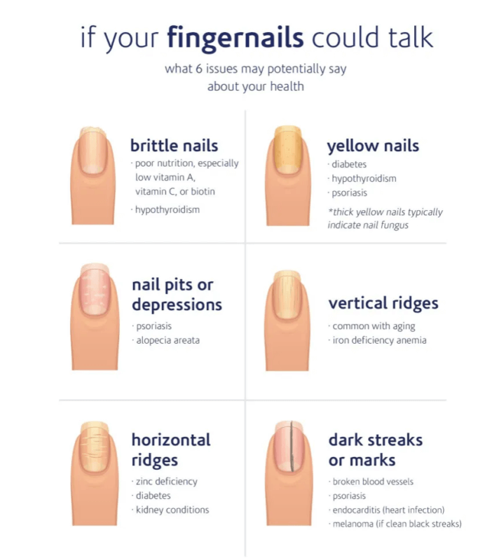 Finger Nail Diagram. (Article: 